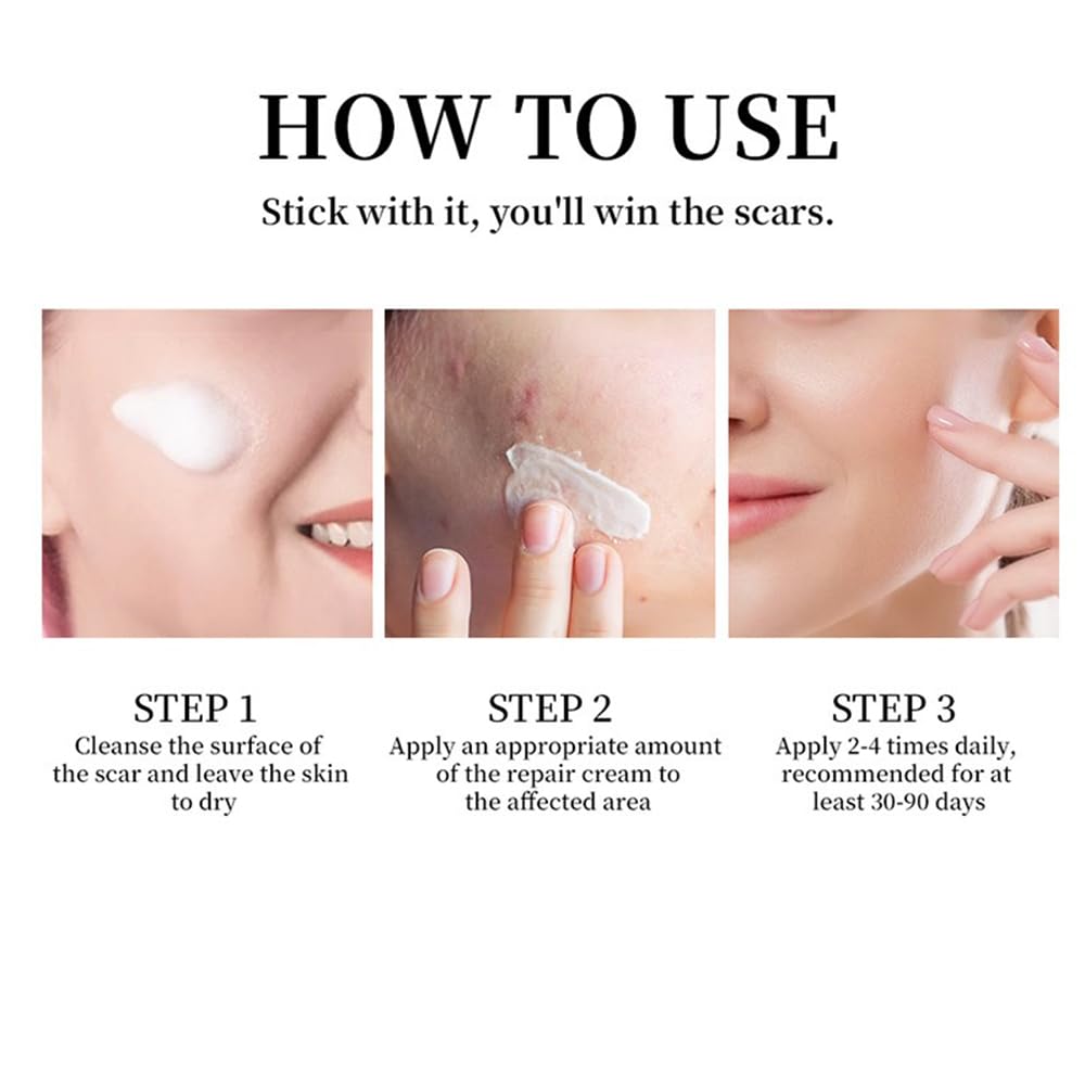 Scar Treatment Cream, Scar Removal Cream for Injury, Burns, Stretch Marks - 50g