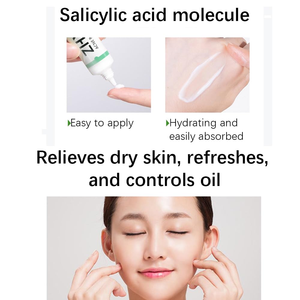 Acne Treatment for Face, Refreshing Acne Cream, Fast Active Blemish Remover