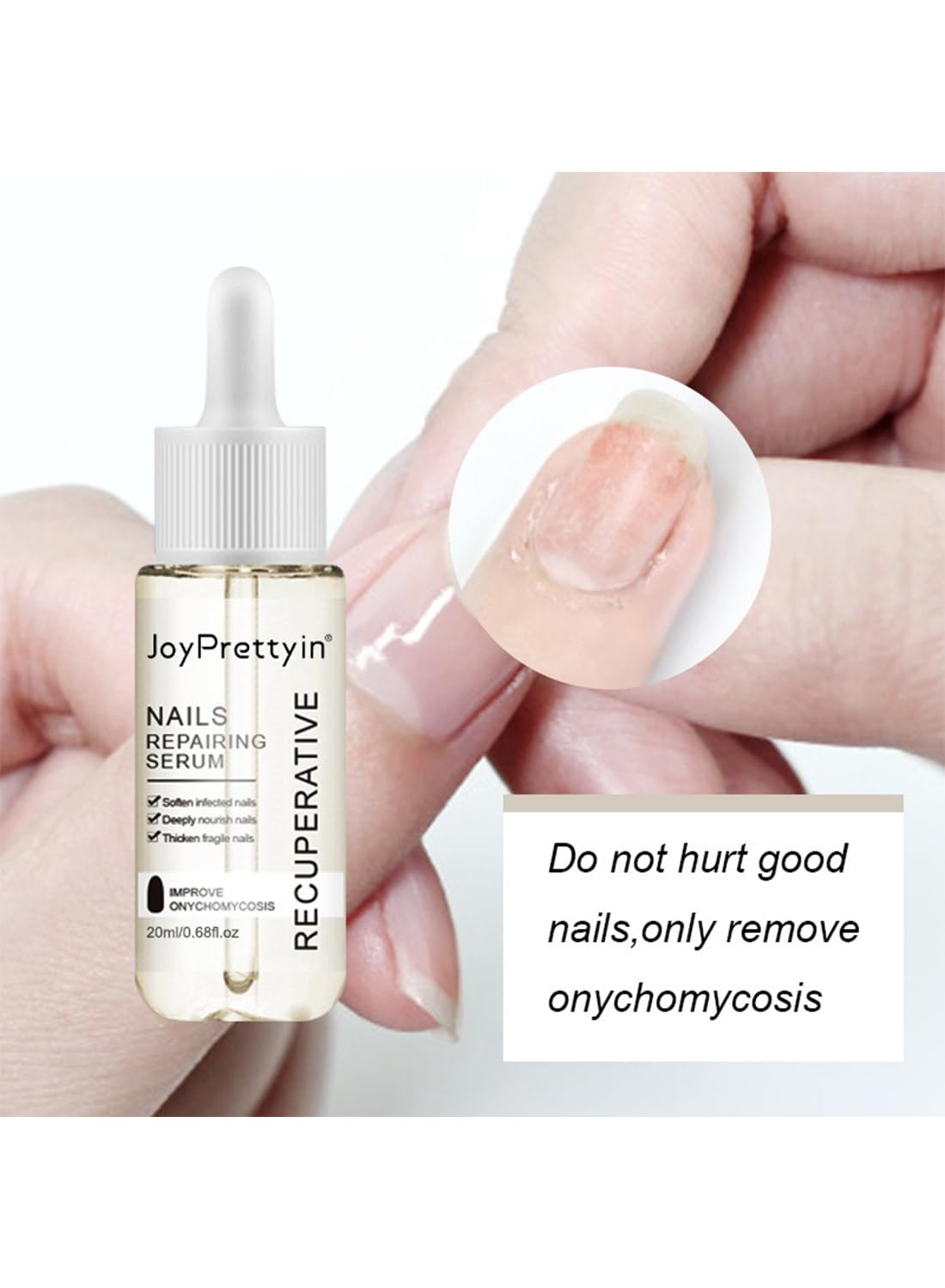 Nail Repair Cream, Nail Grooming Gel for Onychomycosis and Damaged Nails 20 ml