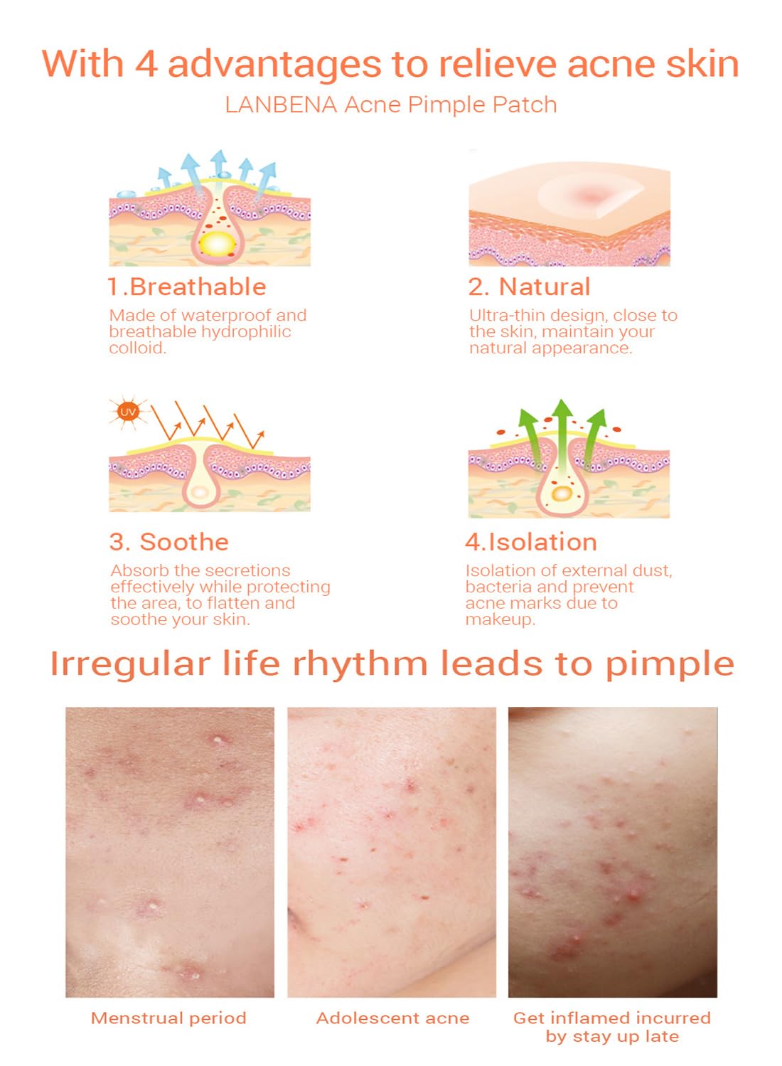 Night Acne pimple patch - 28 Pieces