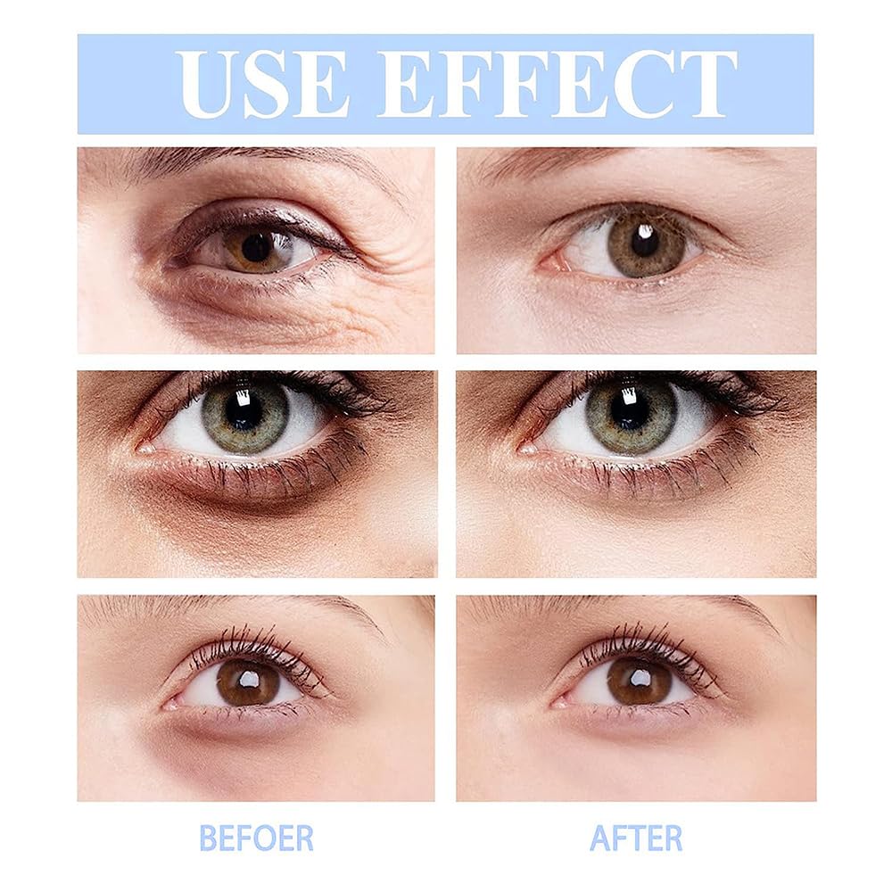 Retinol Eye Cream for Anti-Wrinkle, Anti-Aging Under Eye Treatment Cream, 20g