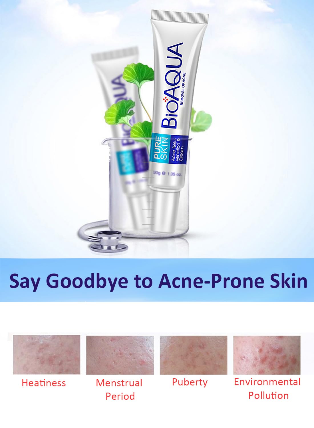 Anti-Acne Facial Treatment Cream, Gentle Face Moisturizer - 1 Pc 30g