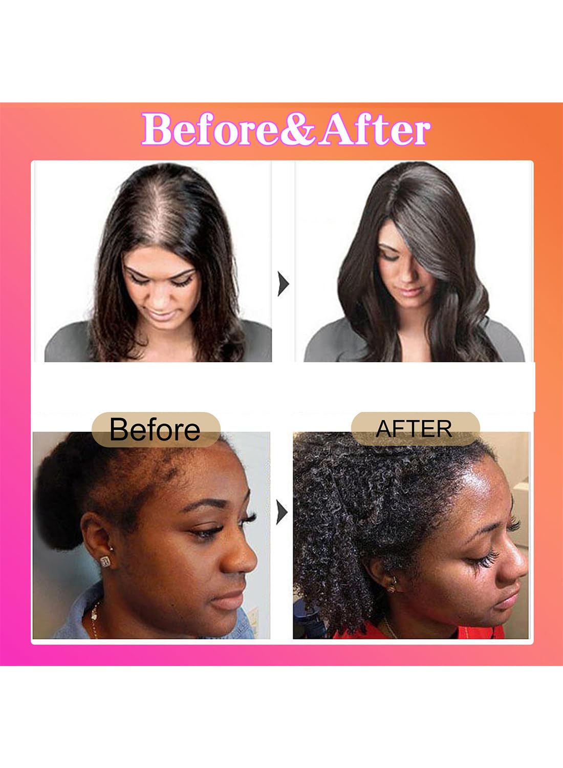 100% Pure Natural Batana oil ,Hair Care Growth Oil For All Hair Types - 30ml