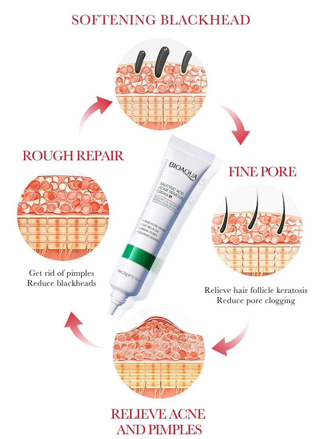 Acne Spot Treatment Cream with Salicylic Acid, Tightening Pore Facial Cream, 20g