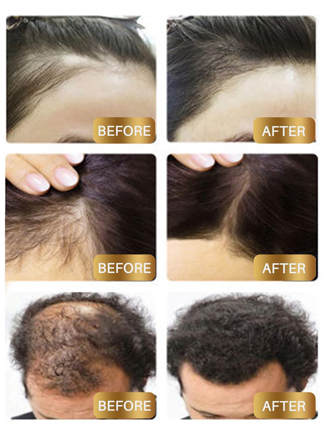 Biotin Hair Growth Serum, Premium Biotin Hair Growth Spray with Castor Oil, Hair Thickening Herbal Serum for Hair Growth, for Thicker Longer & Stronger Hair, Reduces Hair Loss 30ml