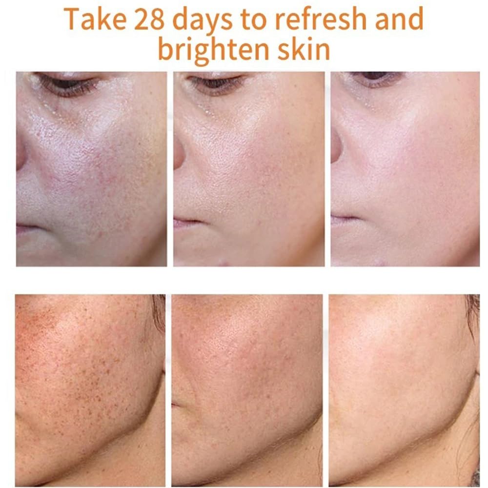 Whitening Facial Cream, Lightening and Freckle-Removing Cream - 20g