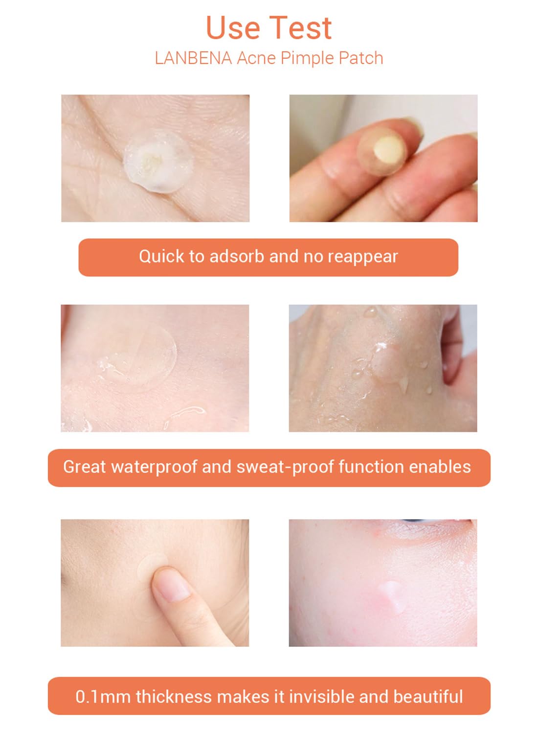 Night Acne pimple patch - 28 Pieces