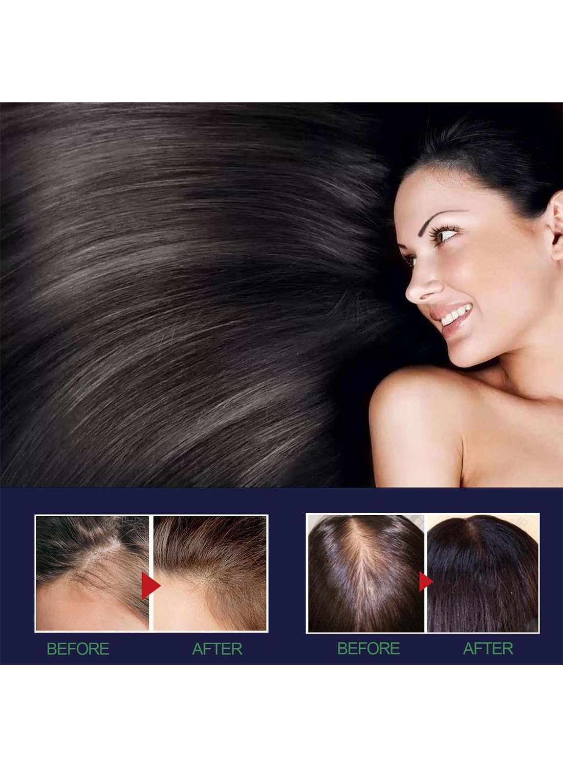 2Pcs Hair Growth Spray Set, Organic Hair Growth Serum, Hair Growth Oil, Hair Loss Treatments, Stimulate New Hair Growth, Strengthen Hair Follicles, Encourage Thicker Fuller Hair 50ml/Pcs