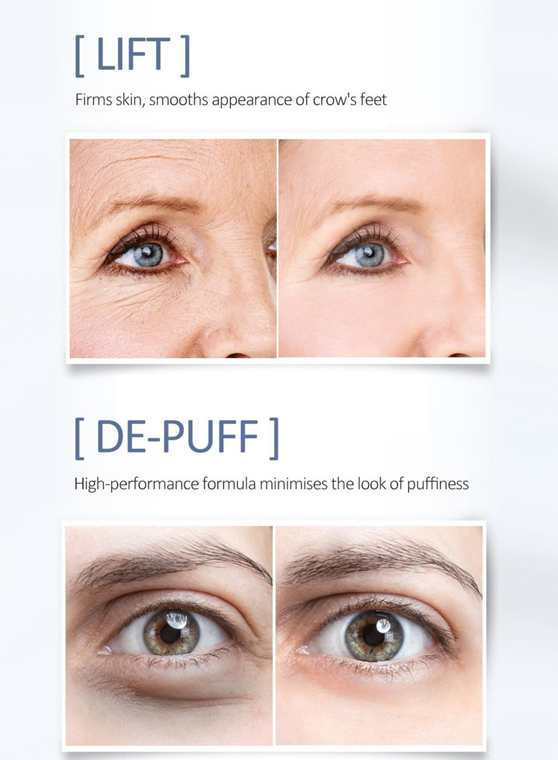 Anti-Aging Eye Serum, Fast-Absorbing Hydrating Eye Skin Care for Eyes 20g