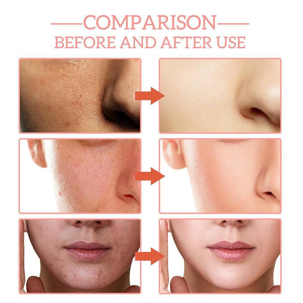 Hyaluronic Acid Serum, Brightening Facial Serum, Non-Greasy Facial Moisturizer