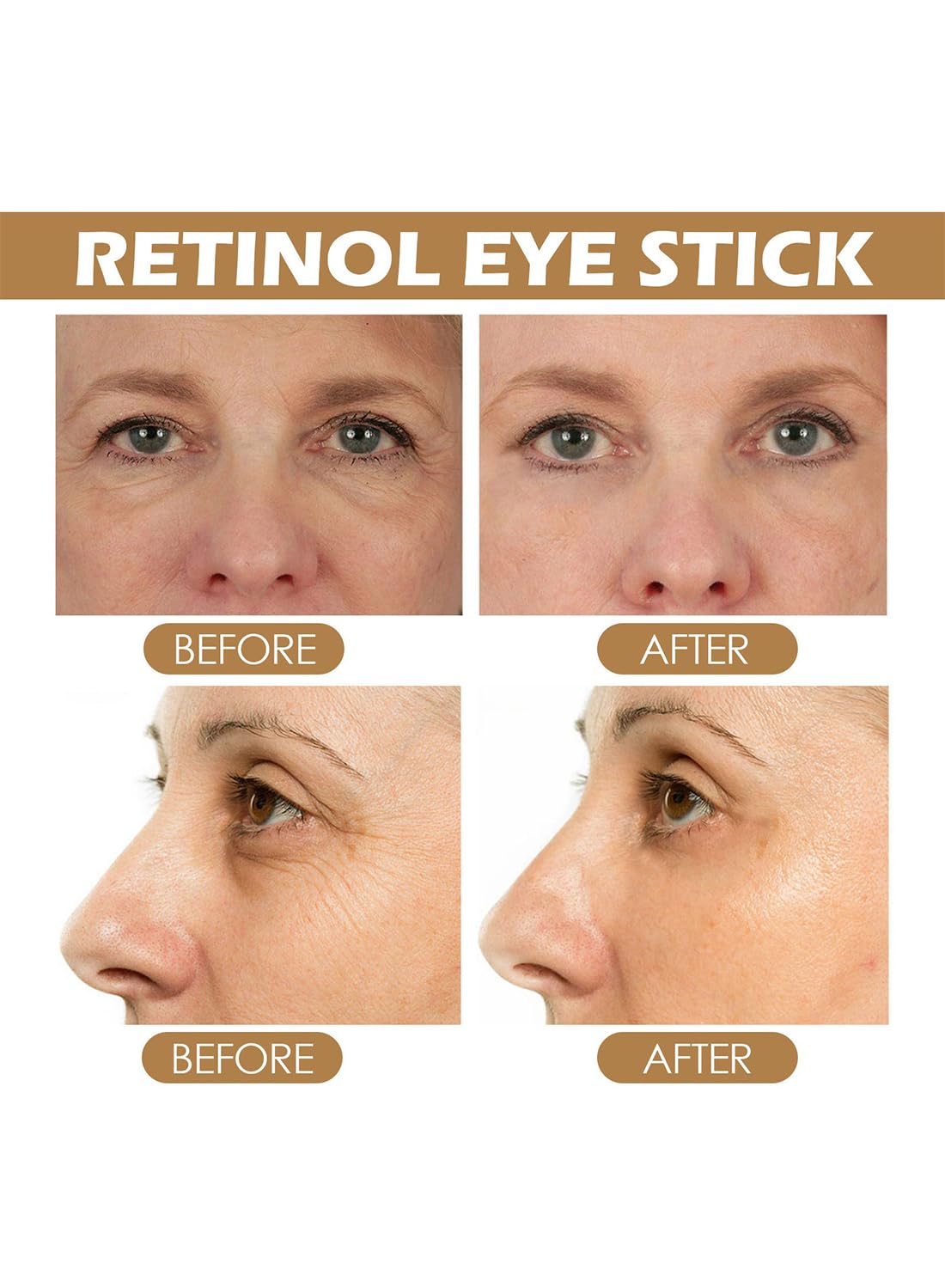 Retinol Under Eye Stick for Anti-Wrinkle and Dark Circle Removal, 1 pc 3ml