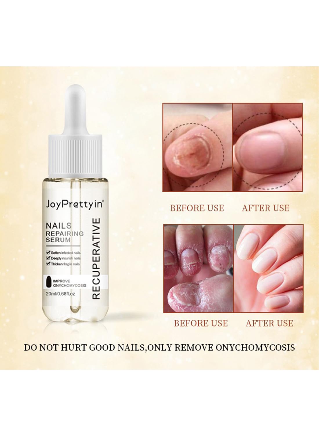 Nail Repair Cream, Nail Grooming Gel for Onychomycosis and Damaged Nails 20 ml