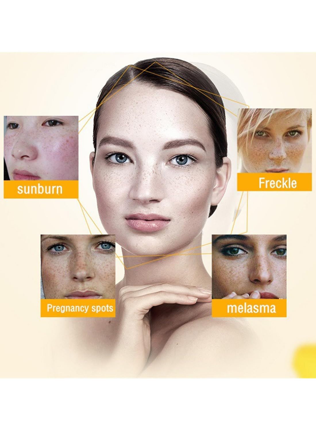 Dark Spot Remover for Face, Mild Whitening Peeling Freckle Cream, Dark Spot Corrector for Sun Spots Age Spots Chloasma, Pigmentation Treatment Lightening Cream 20ml