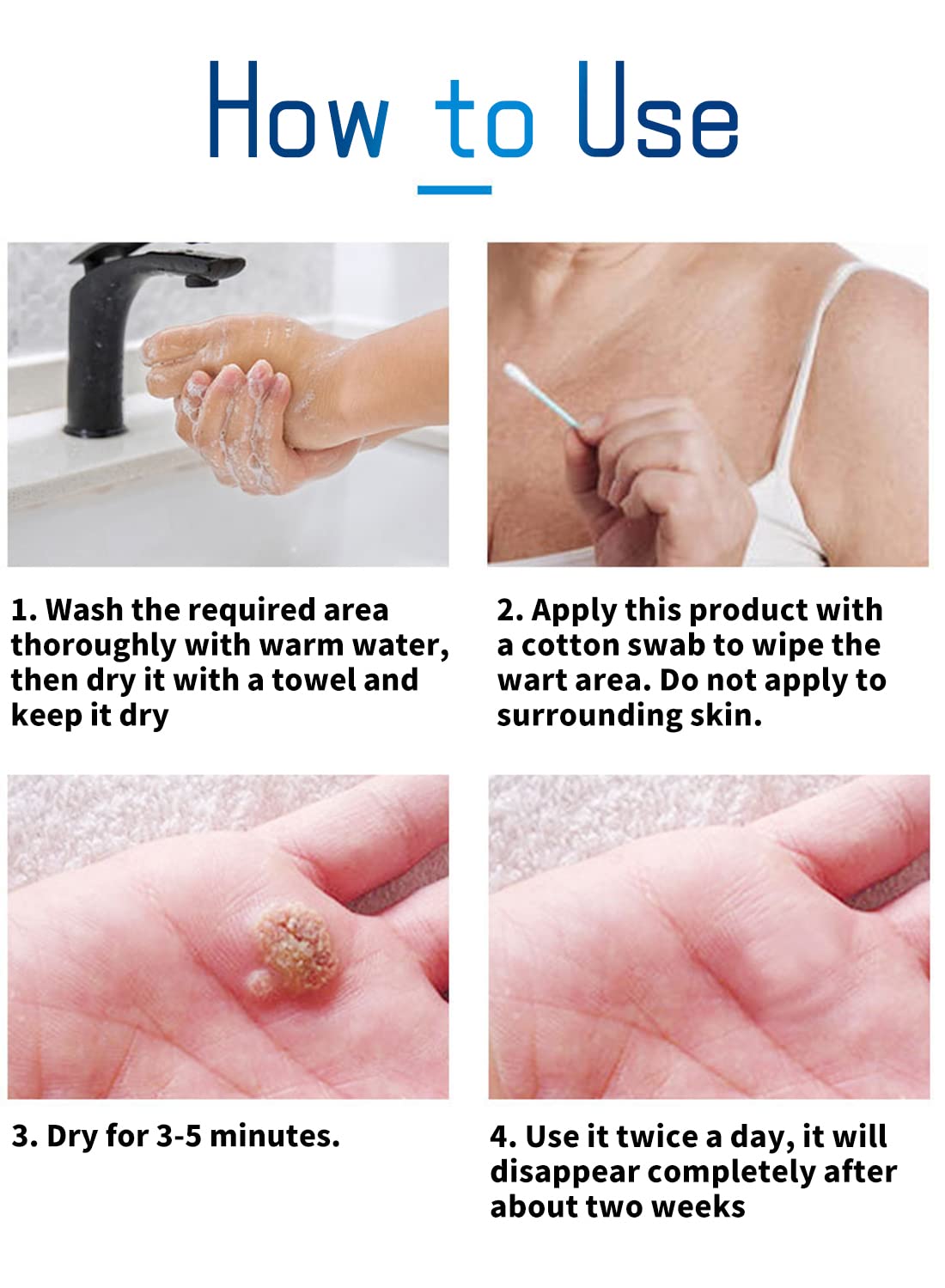 Wart Remover, Fast Acting Stop Wart Regrowth Non Irritating Wart Remover - 10ml