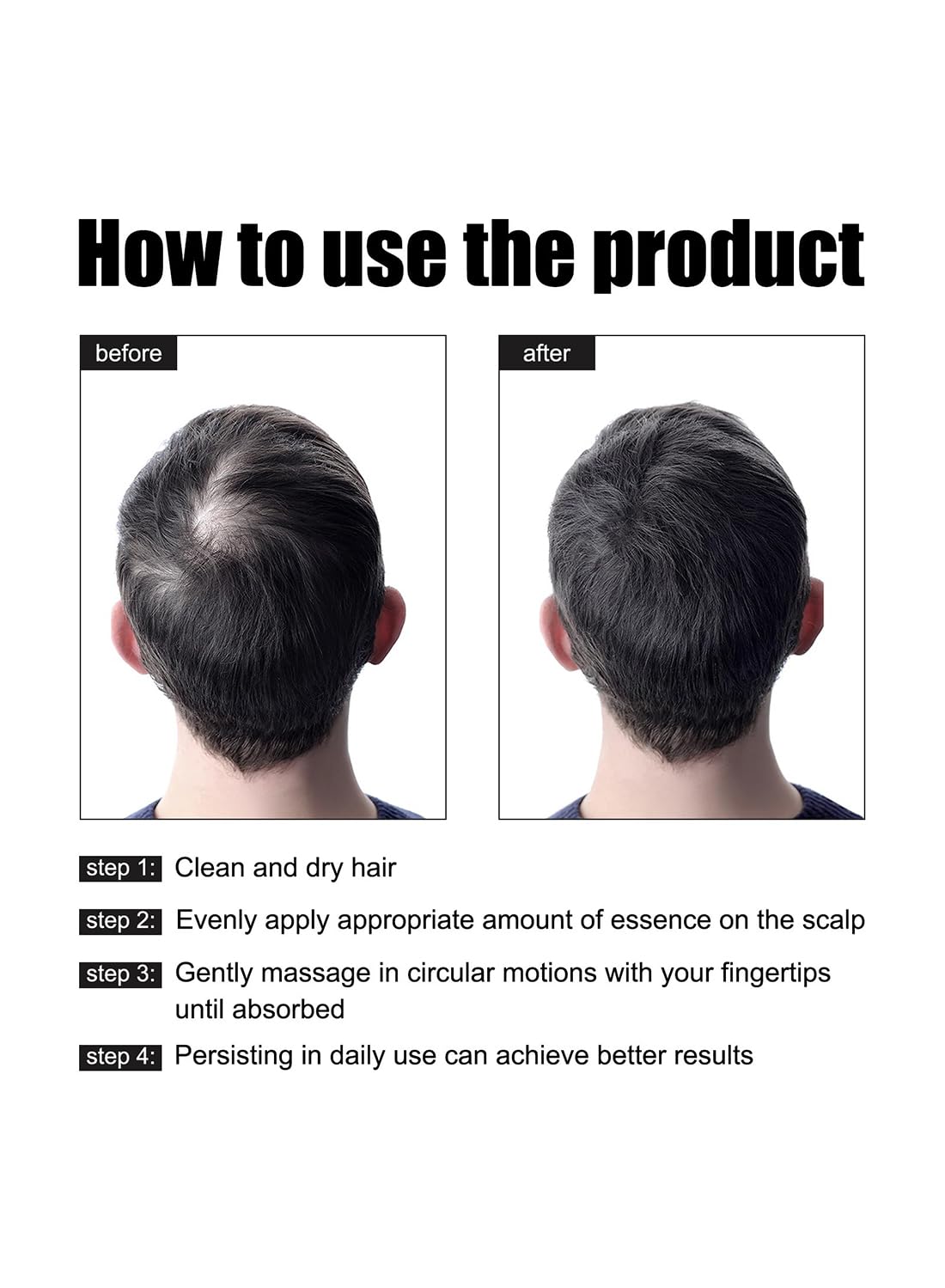 Hair Essence Oil, Hair Care to Promote Healthy Hair Growth and Reduce Frizz 30ml