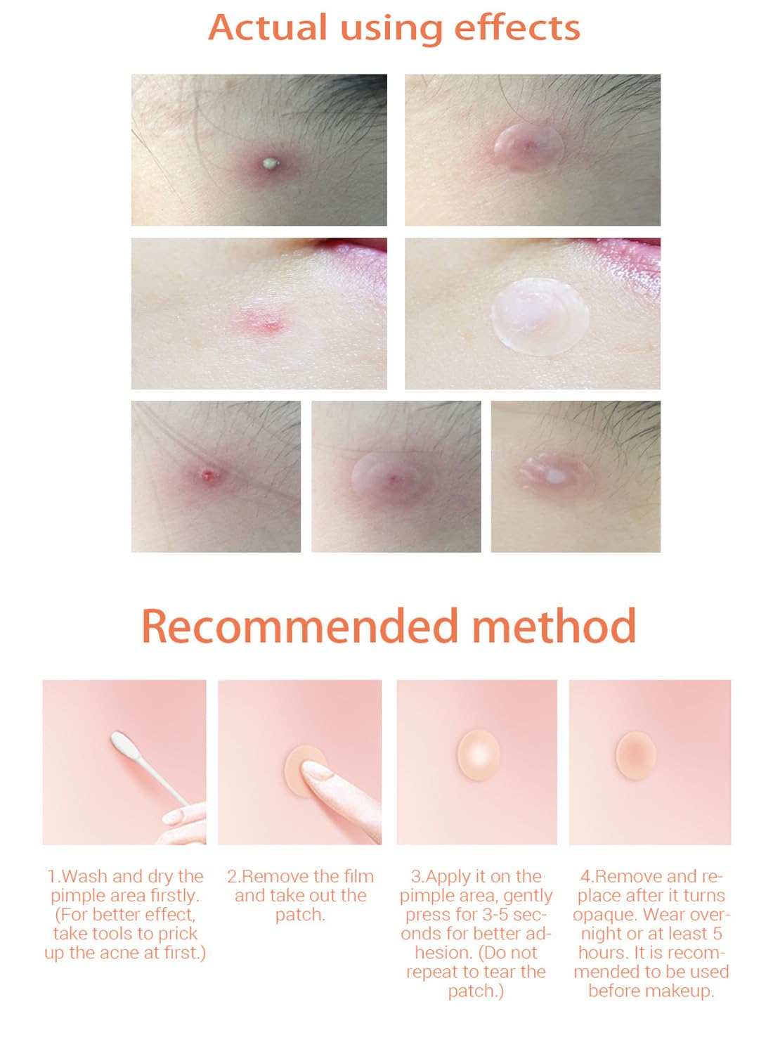 Night Acne pimple patch - 28 Pieces