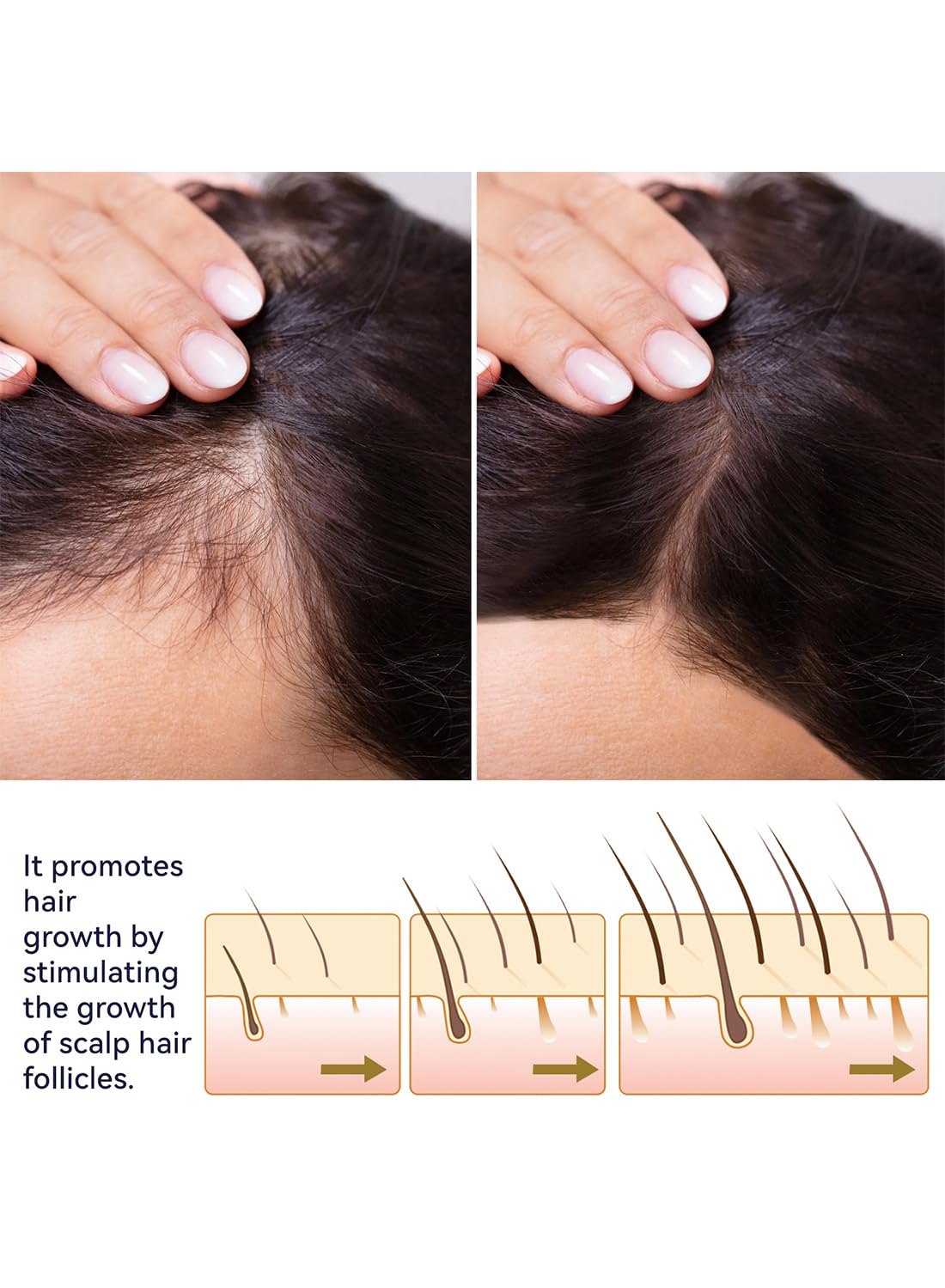 2Pcs Hair Growth Spray Set, Organic Hair Growth Serum, Hair Growth Oil, Hair Loss Treatments, Stimulate New Hair Growth, Strengthen Hair Follicles, Encourage Thicker Fuller Hair 50ml/Pcs
