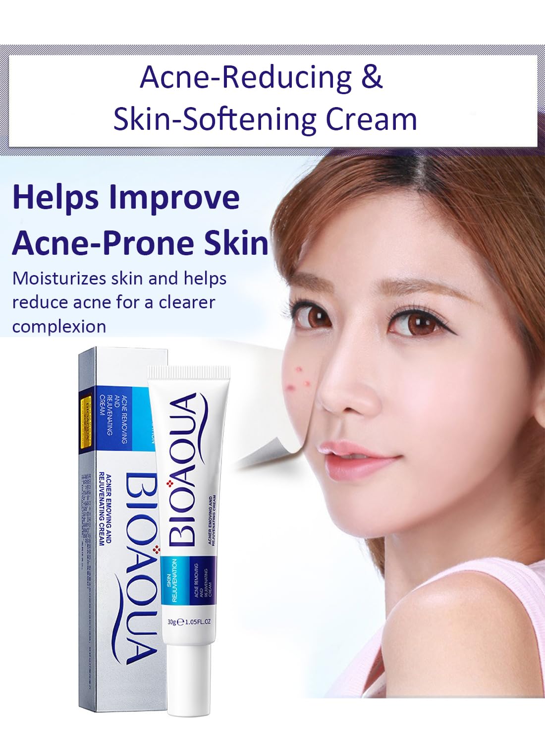 Anti-Acne Facial Treatment Cream, Gentle Face Moisturizer - 1 Pc 30g