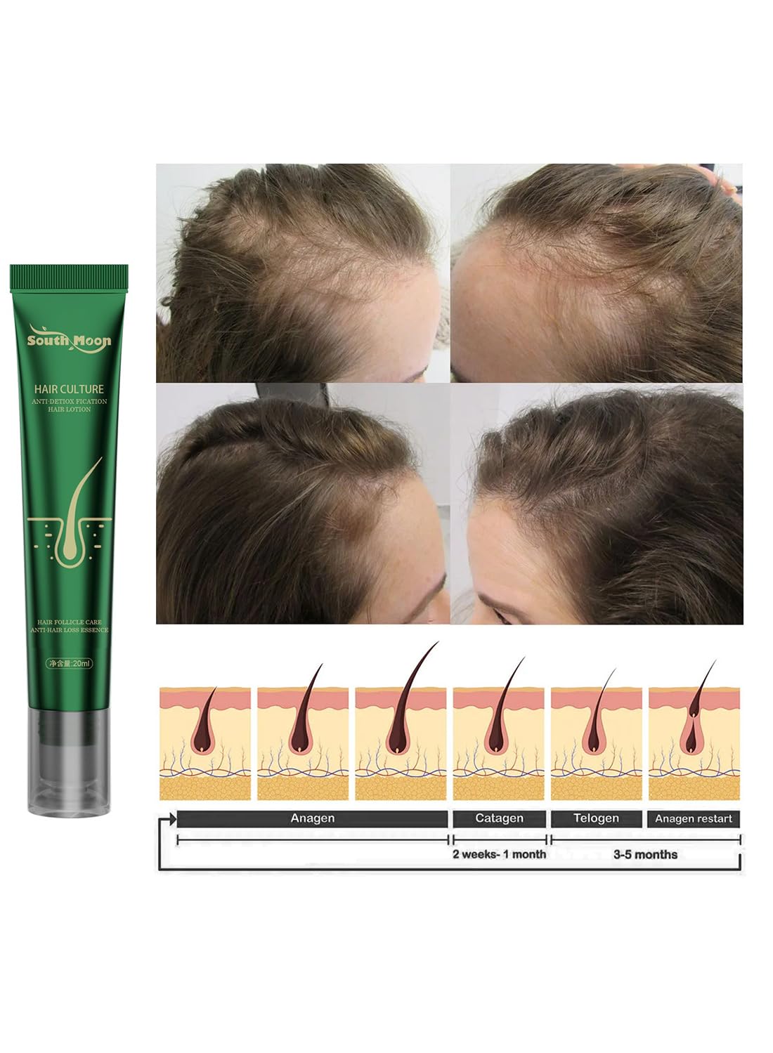 Hair Growth Serum, Anti Hair Loss Essence, Strengthening Hair Regrowth Oil, Hair Loss Treatment, Repair Hair Damage, for Thicker Longer Fuller Hair 20ML