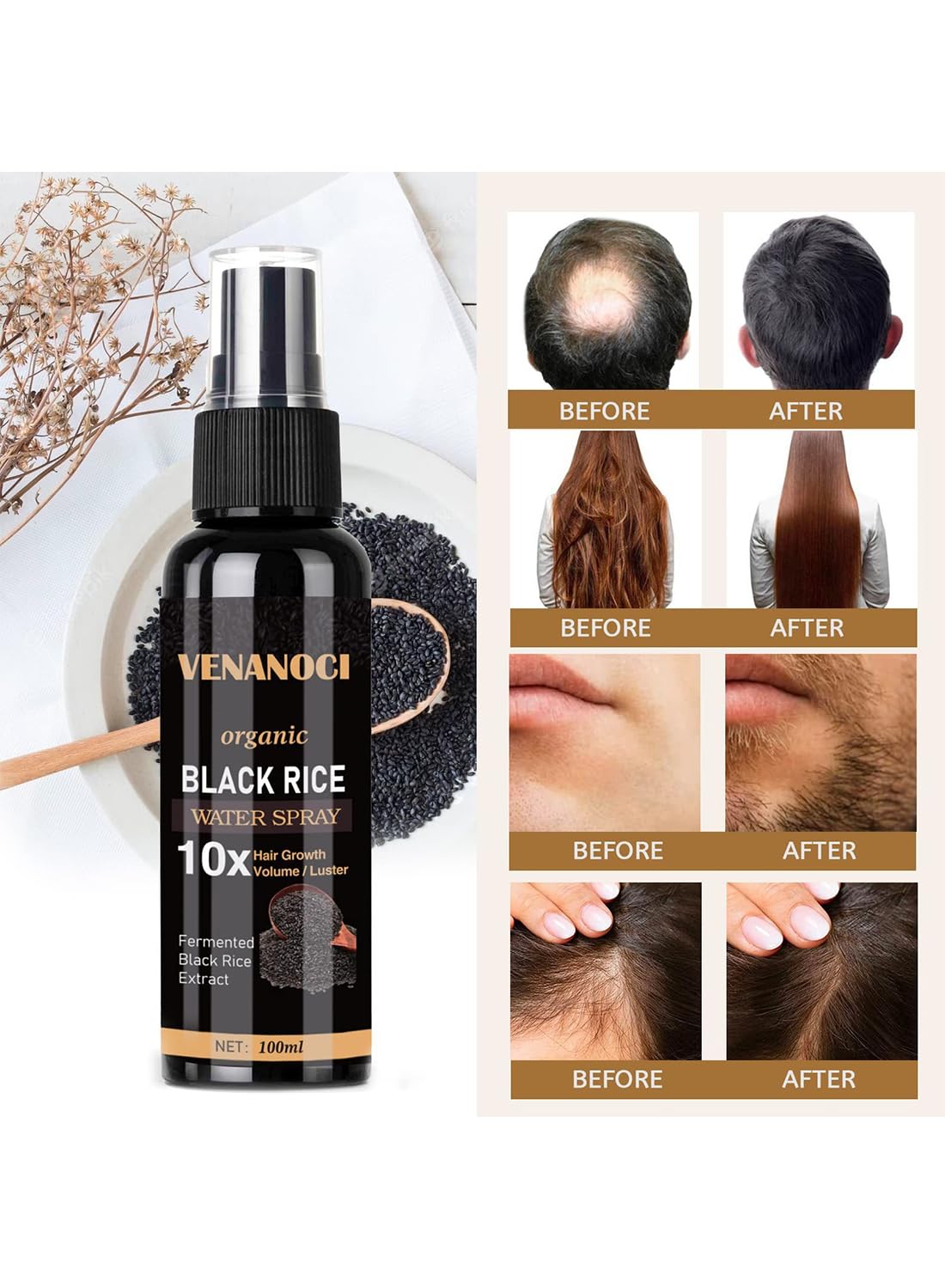 Hair Helper Spray, Moisturizing Strengthening Hair Growth Spray for Thinning Hair, Anti Hair Loss Volumizing Organic Black Rice Water Spray for Hair Growth, Restore Dry Damaged Hair 100ml