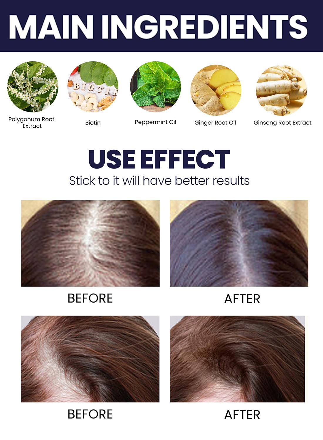 2Pcs Hair Growth Spray Set, Organic Hair Growth Serum, Hair Growth Oil, Hair Loss Treatments, Stimulate New Hair Growth, Strengthen Hair Follicles, Encourage Thicker Fuller Hair 50ml/Pcs