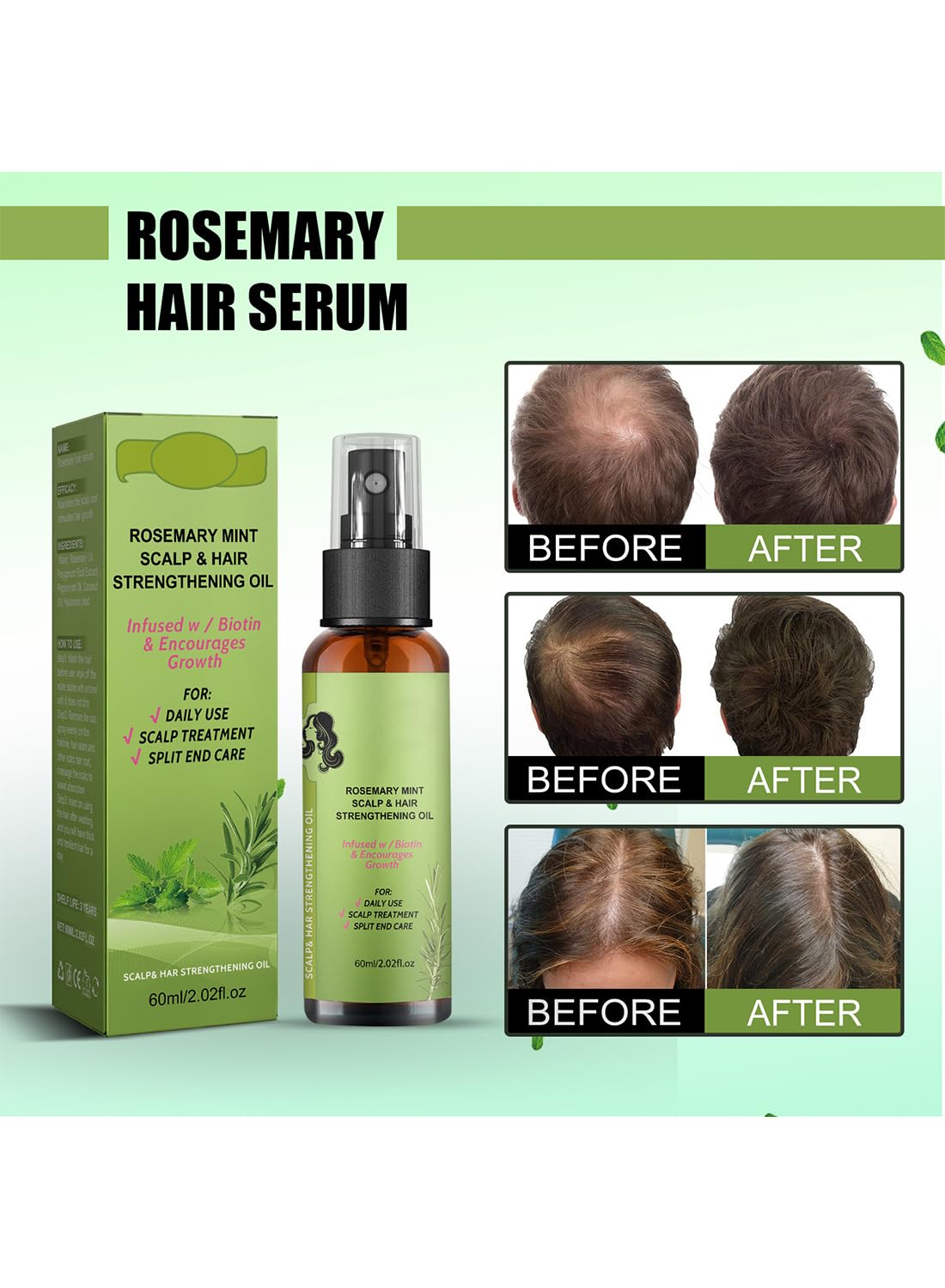 L&Wen 2Pcs Rosemary Mint Scalp & Hair Strengthening Oil Spray Set Hair Growth Oil