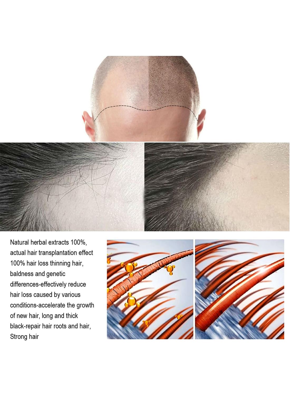 Hair Growth Serum, Anti Hair Loss Essence, Strengthening Hair Regrowth Oil, Hair Loss Treatment, Repair Hair Damage, for Thicker Longer Fuller Hair 20ML