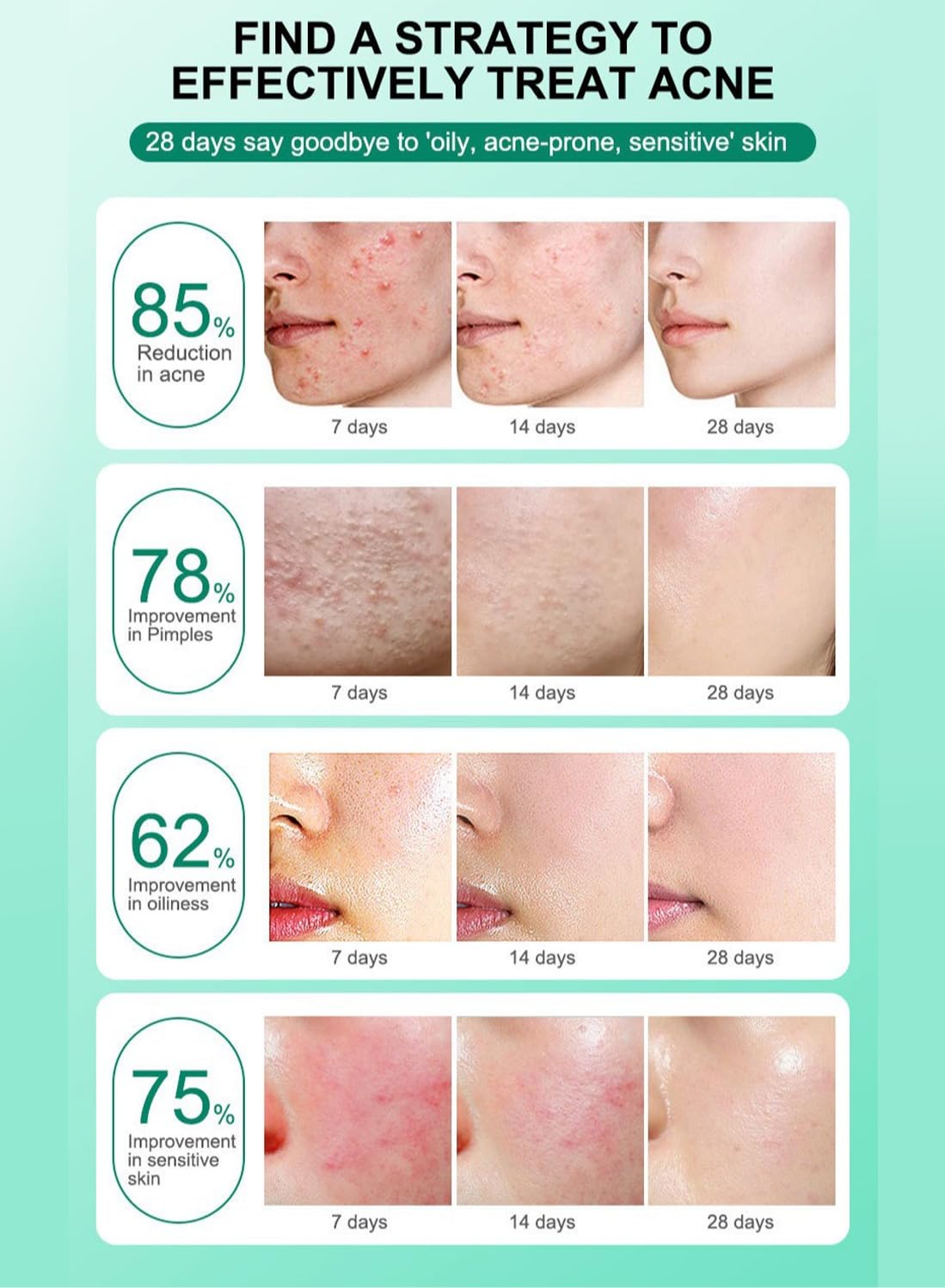 Anti-Acne Facial Treatment, Repairing and Soothing Facial Cream 15g