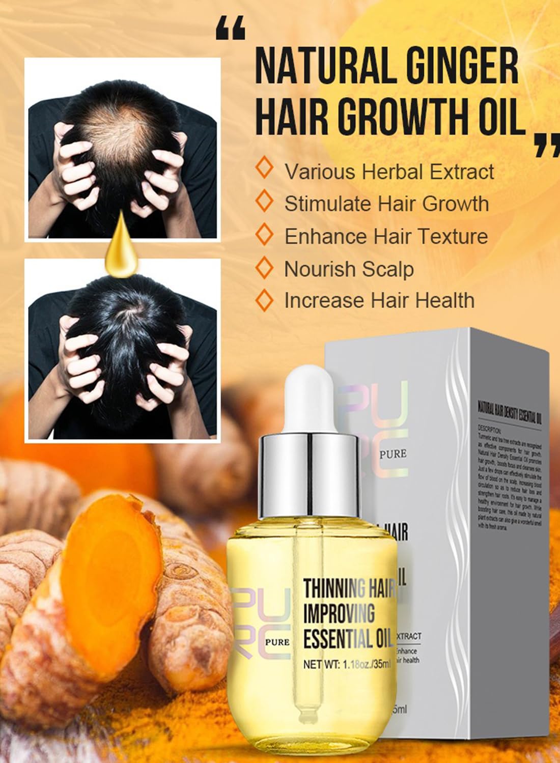 Hair Essential Oil, Turmeric Scalp & Hair Strengthening Oil, Pure Natural Hair Growth Oil for Hair Growth, Scalp Treatment for Thicker Longer Fuller Healthier Hair, Improve Thinning Hair 35ML