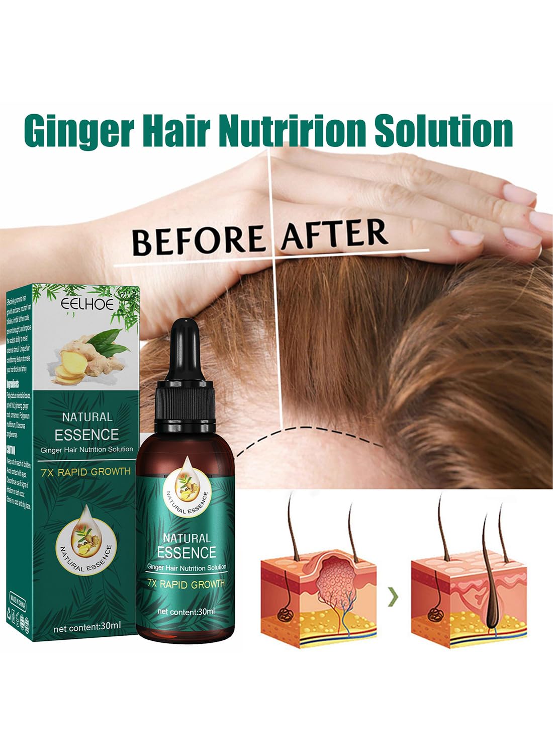 Natural Essence Ginger Hair Nutrition Solution, Ginger Hair Growth Serum, Non Greasy Hair Growth Oil to Prevent Hair Loss and Stimulate Hair Growth for Stronger, Thicker, Longer Hair 30ml