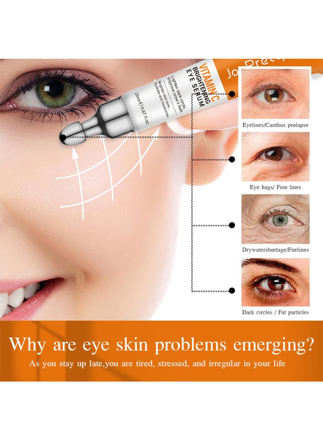 L&Wen Vitamin C Serum, Brightening Anti Aging Eye Serum, Remove Dark Circles Puffiness Under Eye Bags Fine Line, Reduce Wrinkle, Dark Spot Remover, Even Skin Tone, Boost Skin Elasticity 20ml