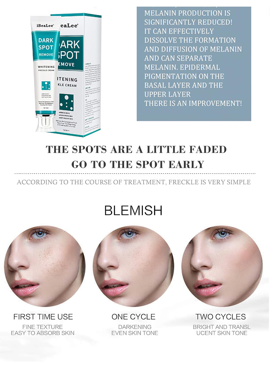Dark Spot Remover for Face, Mild Whitening Peeling Freckle Cream, Dark Spot Corrector for Sun Spots Age Spots Chloasma, Pigmentation Treatment Lightening Cream 20ml