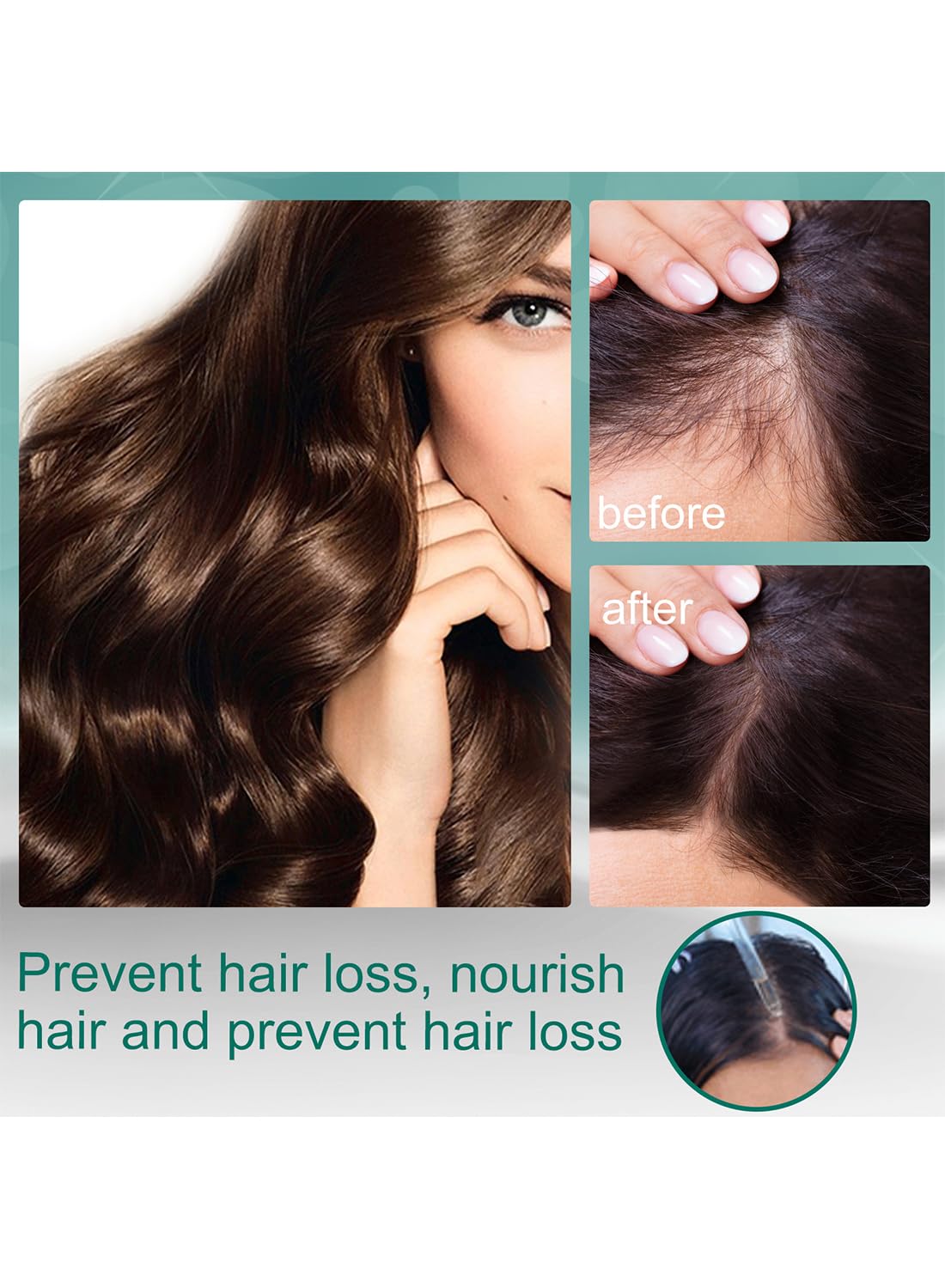 Natural Essence Ginger Hair Nutrition Solution, Ginger Hair Growth Serum, Non Greasy Hair Growth Oil to Prevent Hair Loss and Stimulate Hair Growth for Stronger, Thicker, Longer Hair 30ml