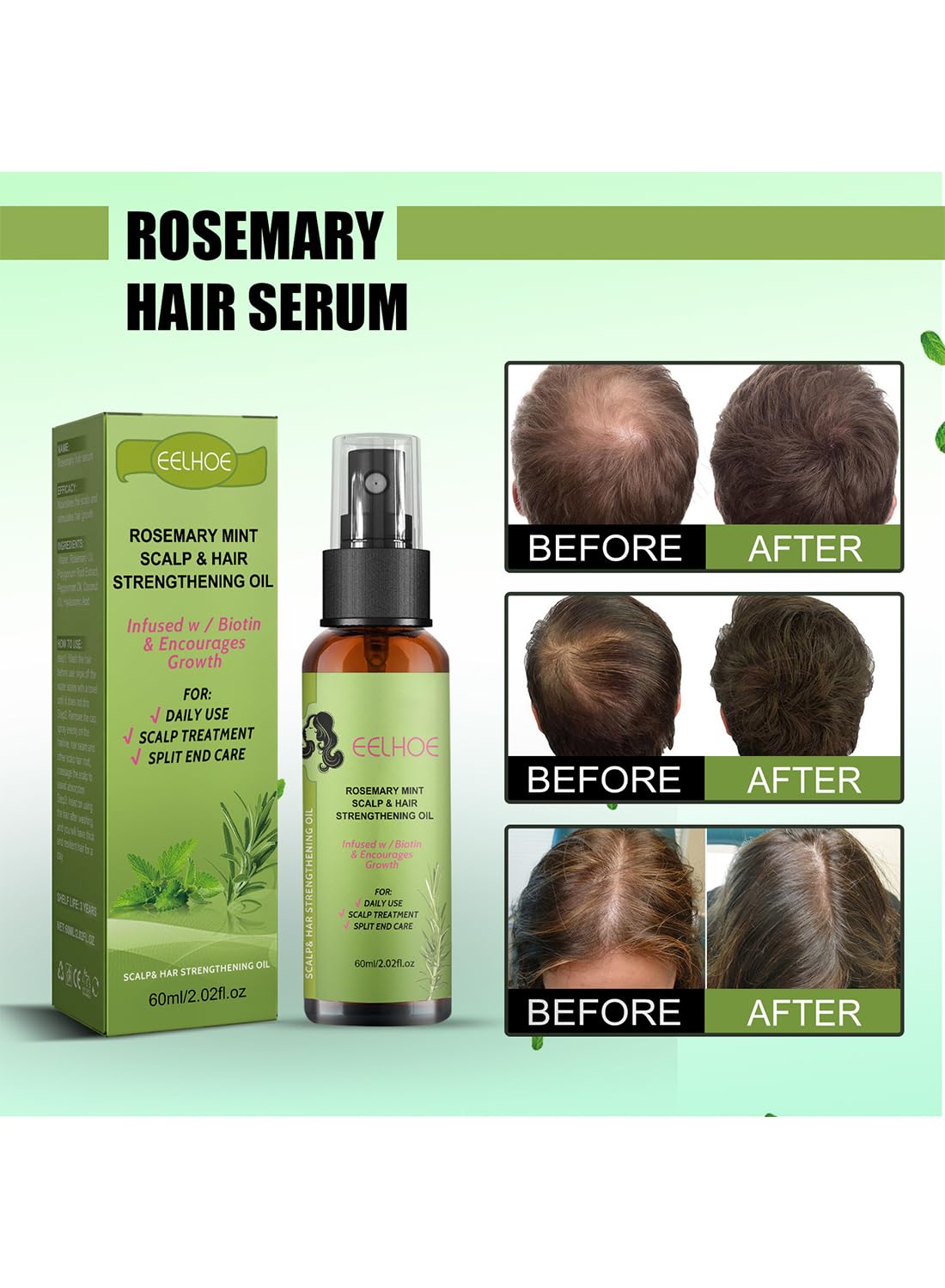 2Pcs Rosemary Mint Scalp & Hair Strengthening Oil Spray Set Hair Growth Oil to Help Stimulate New Hair Growth and Strengthen Hair Follicles and Encourage Thicker Fuller Hair 60ml/Pcs