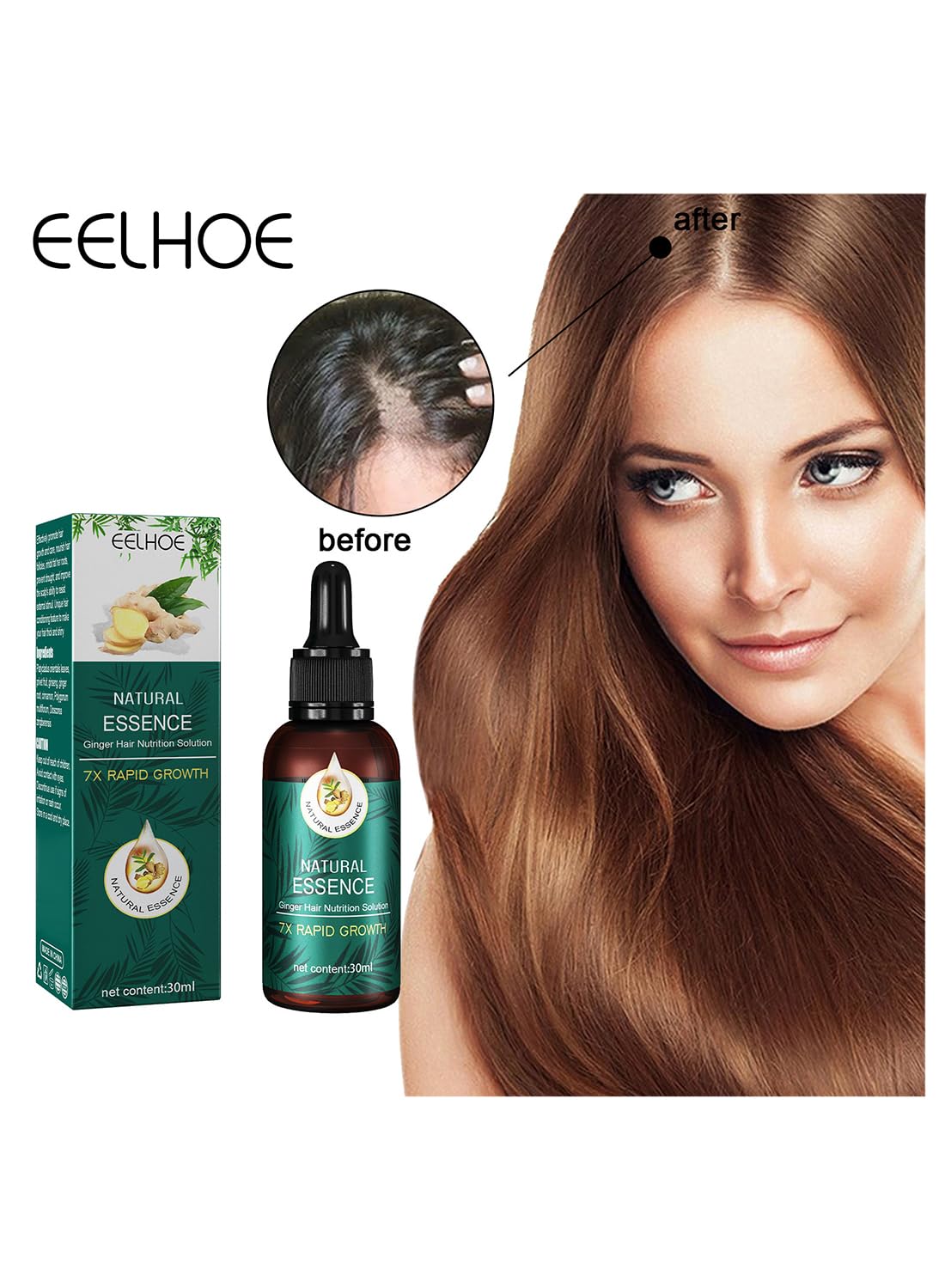 Natural Essence Ginger Hair Nutrition Solution, Ginger Hair Growth Serum, Non Greasy Hair Growth Oil to Prevent Hair Loss and Stimulate Hair Growth for Stronger, Thicker, Longer Hair 30ml
