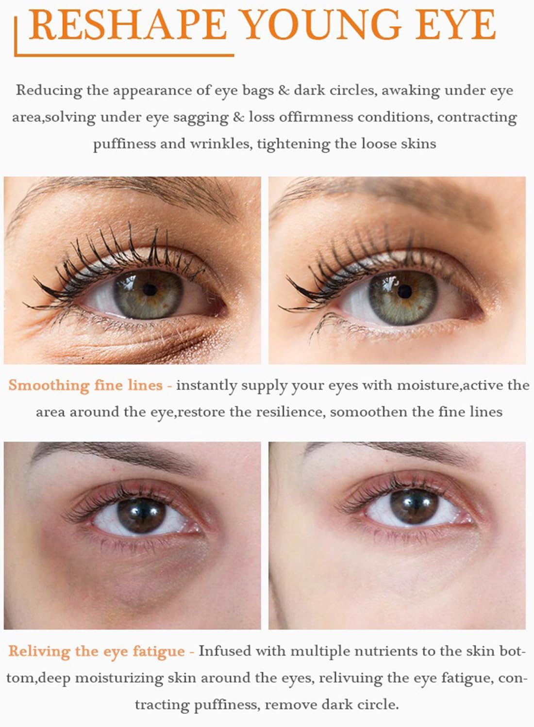 Vitamin C Brightening Eye Serum, Hydrating Under-Eye Gel, Evens Tone, Boosts Radiance, Reduce Dark Circles & Puffiness, 20 ml