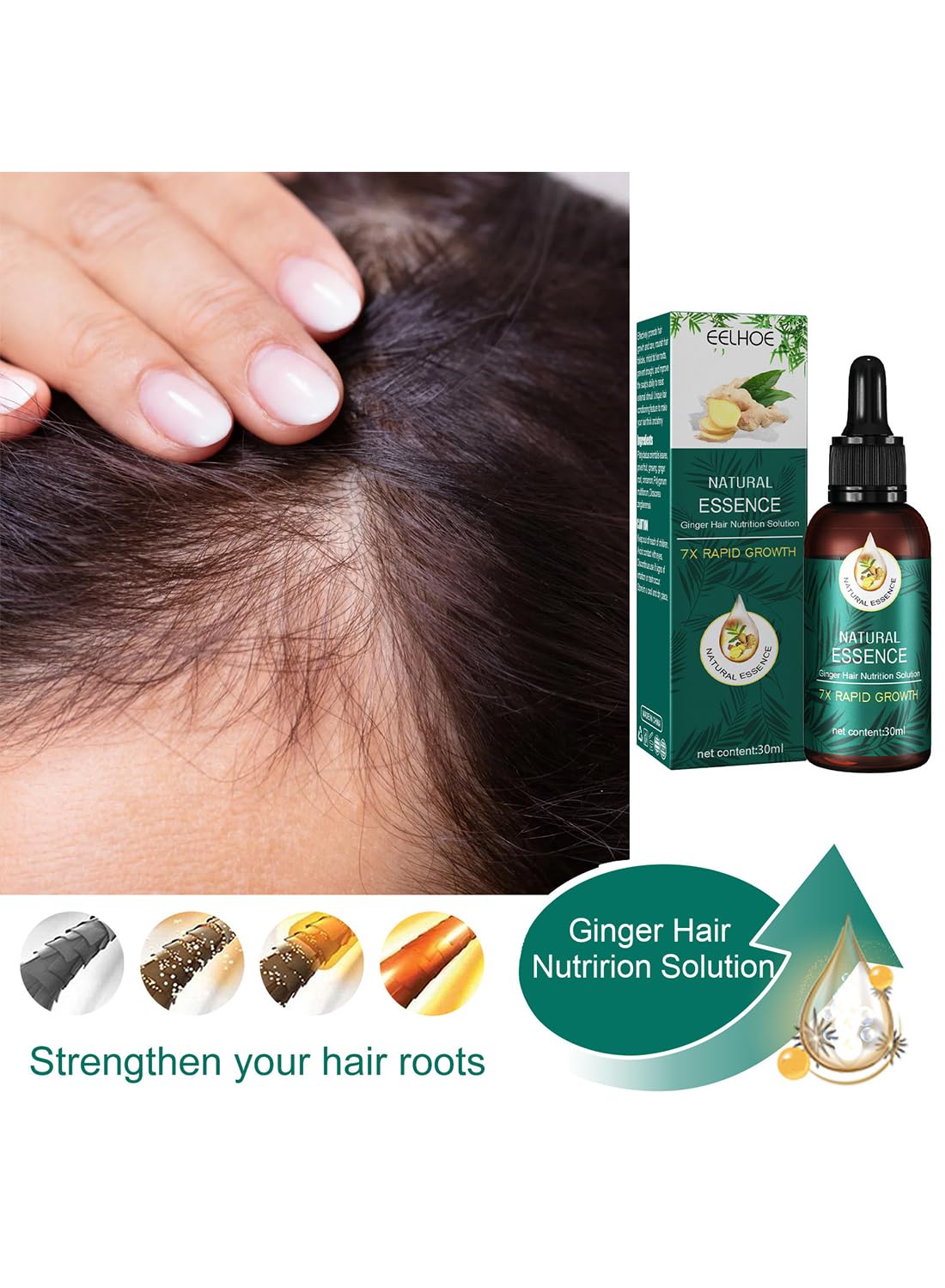 Natural Essence Ginger Hair Nutrition Solution, Ginger Hair Growth Serum, Non Greasy Hair Growth Oil to Prevent Hair Loss and Stimulate Hair Growth for Stronger, Thicker, Longer Hair 30ml