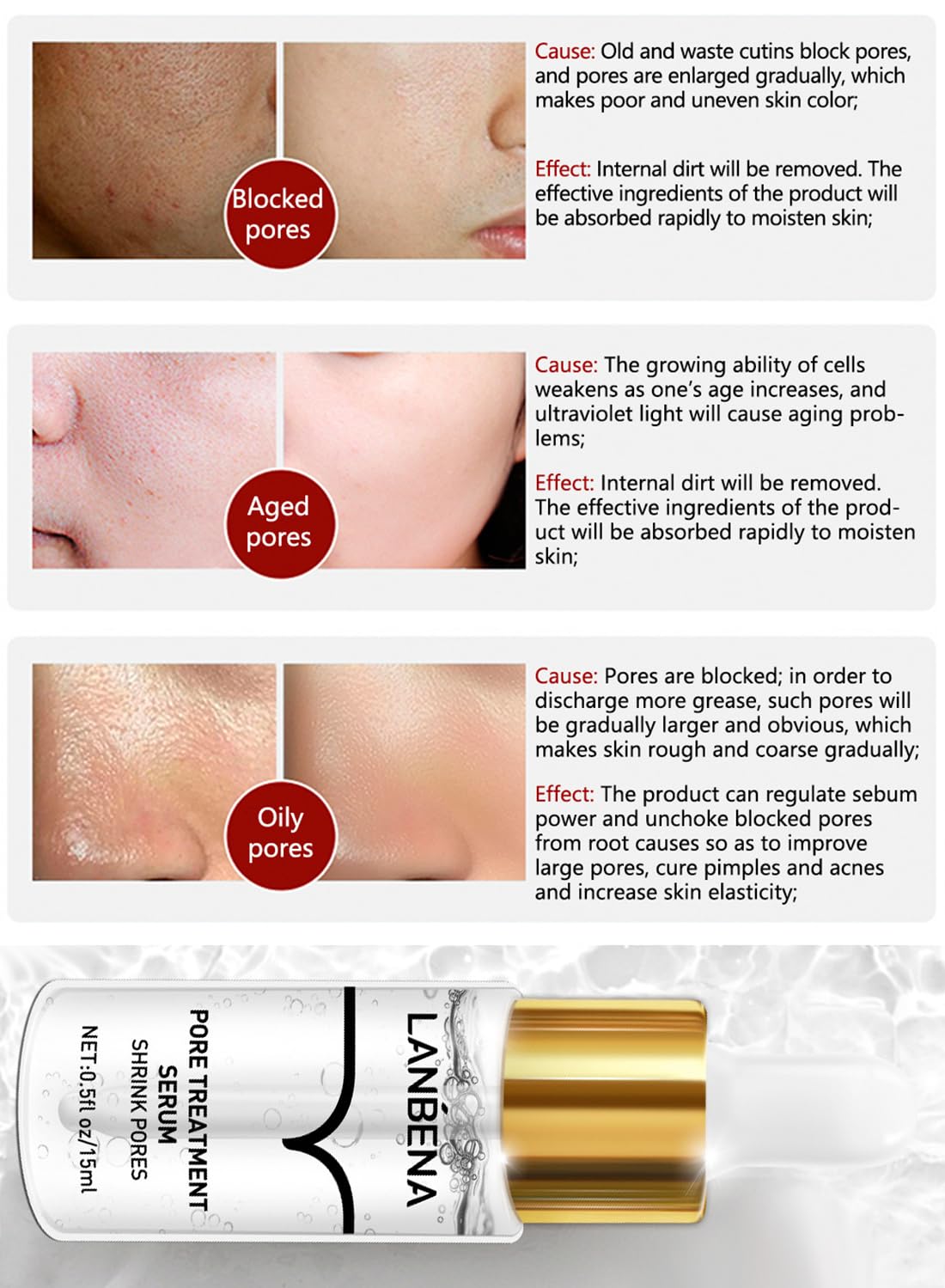 Blackhead Remover, Pore Solution Serum for Face and Nose 15ml