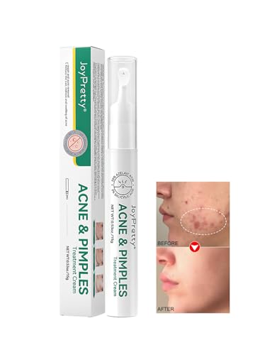 Anti-Acne Facial Treatment, Repairing and Soothing Facial Cream 15g