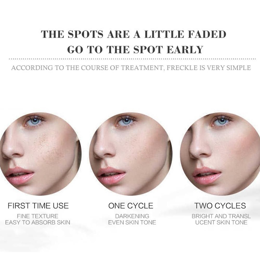 Whitening Facial Cream, Lightening and Freckle-Removing Cream - 20g