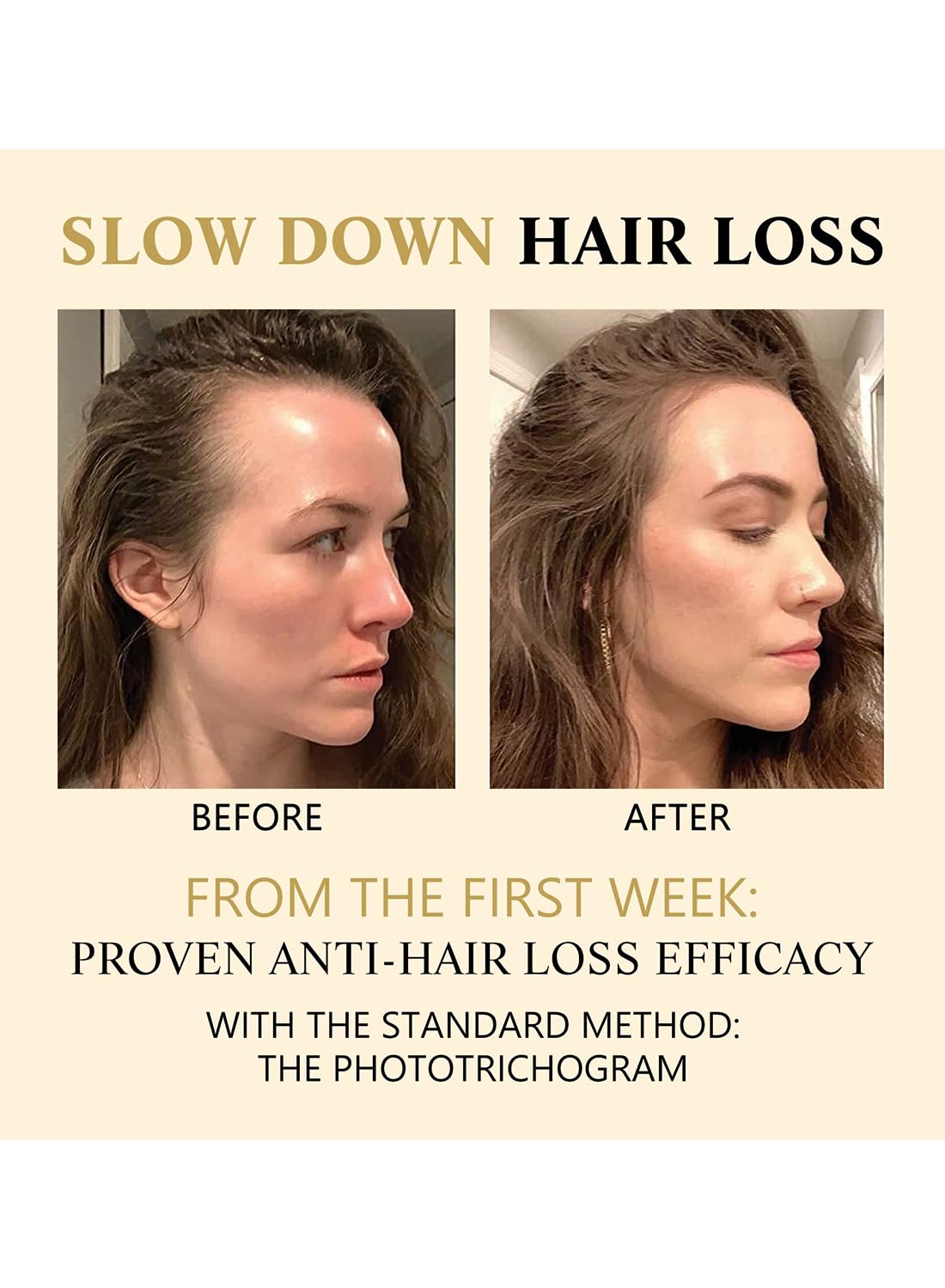 Hair Loss Treatment for Hair Growth, Anti Hair Loss Roll On Massage Hair Boost Essence, Darkens & Strengthens & Promotes Hair Circulation, Reduces Hair Loss, Restores Thin Hair 20ml