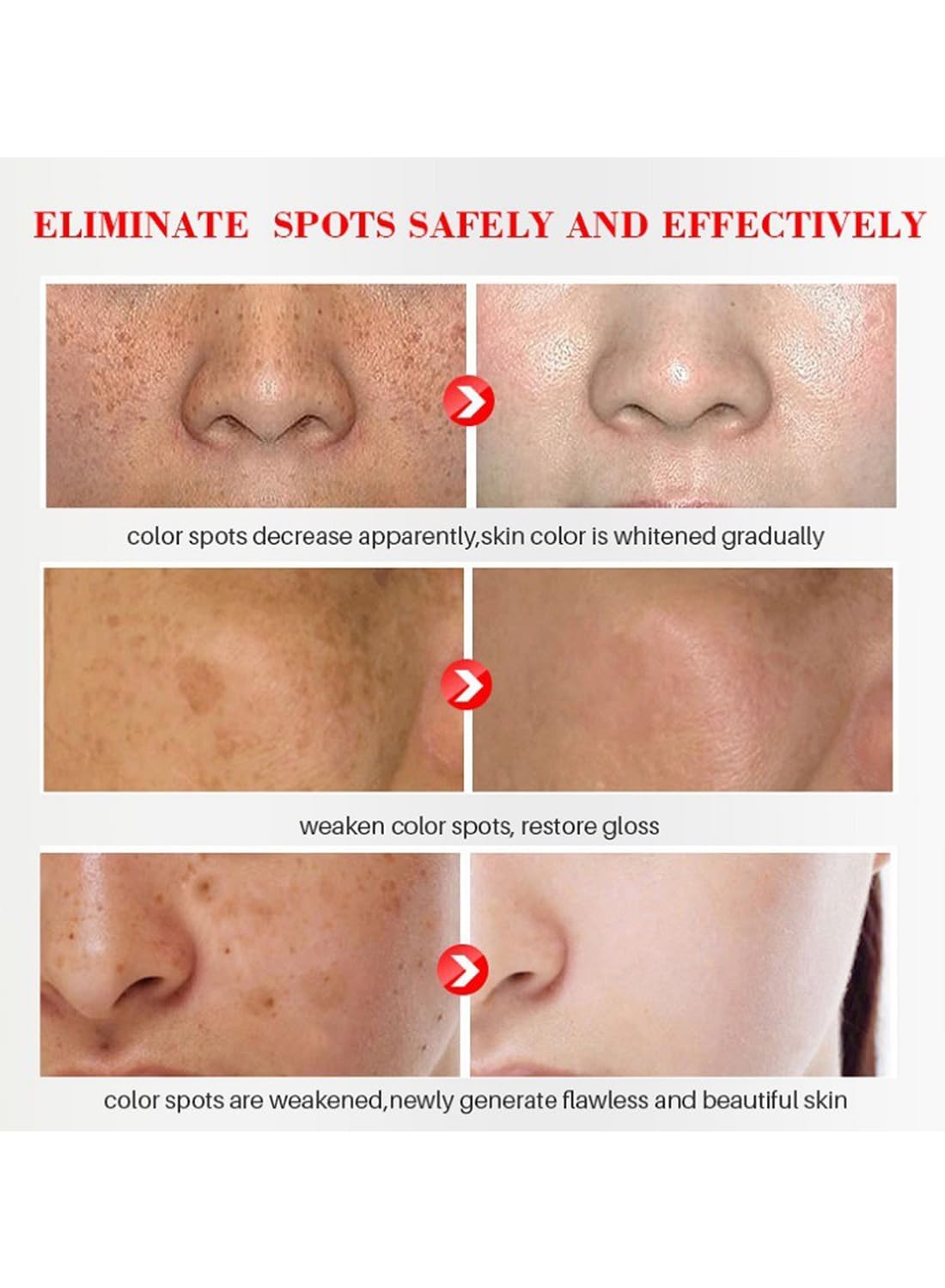 Dark Spot Remover for Face, Mild Whitening Peeling Freckle Cream, Dark Spot Corrector for Sun Spots Age Spots Chloasma, Pigmentation Treatment Lightening Cream 20ml