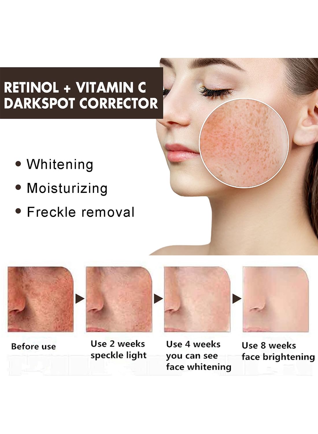 Dark Spot Remover Cream with Retinol and Vitamin C for Face and Body, 29ml