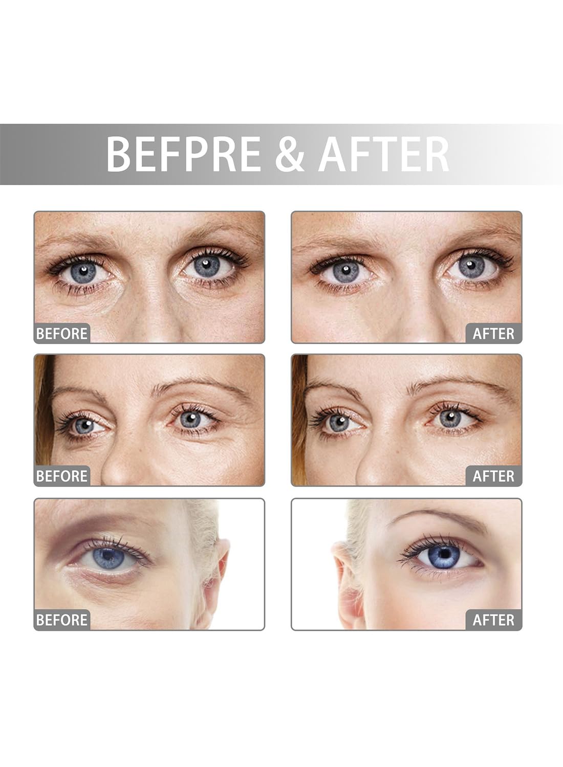 Eye Treatment Serum with a Roller, Anti-Wrinkle Nourishing Eye Essence, 20ml