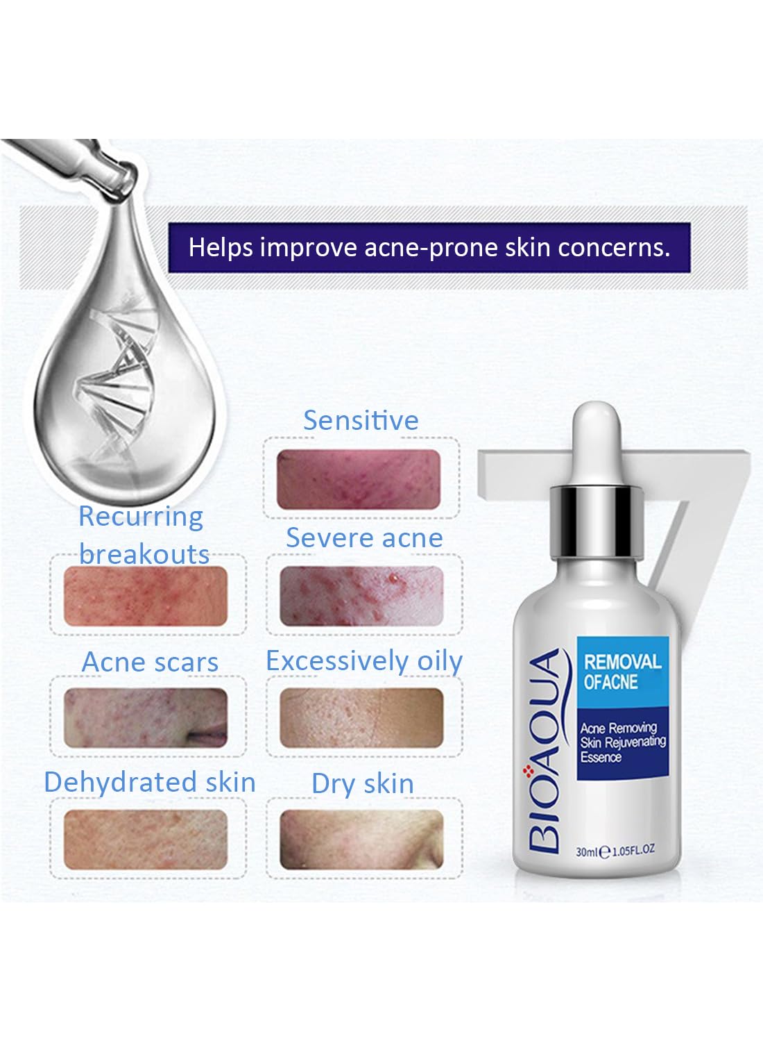 Anti-Acne Facial Serum, Gentle Face Moisturizer - 1 PC 30ml