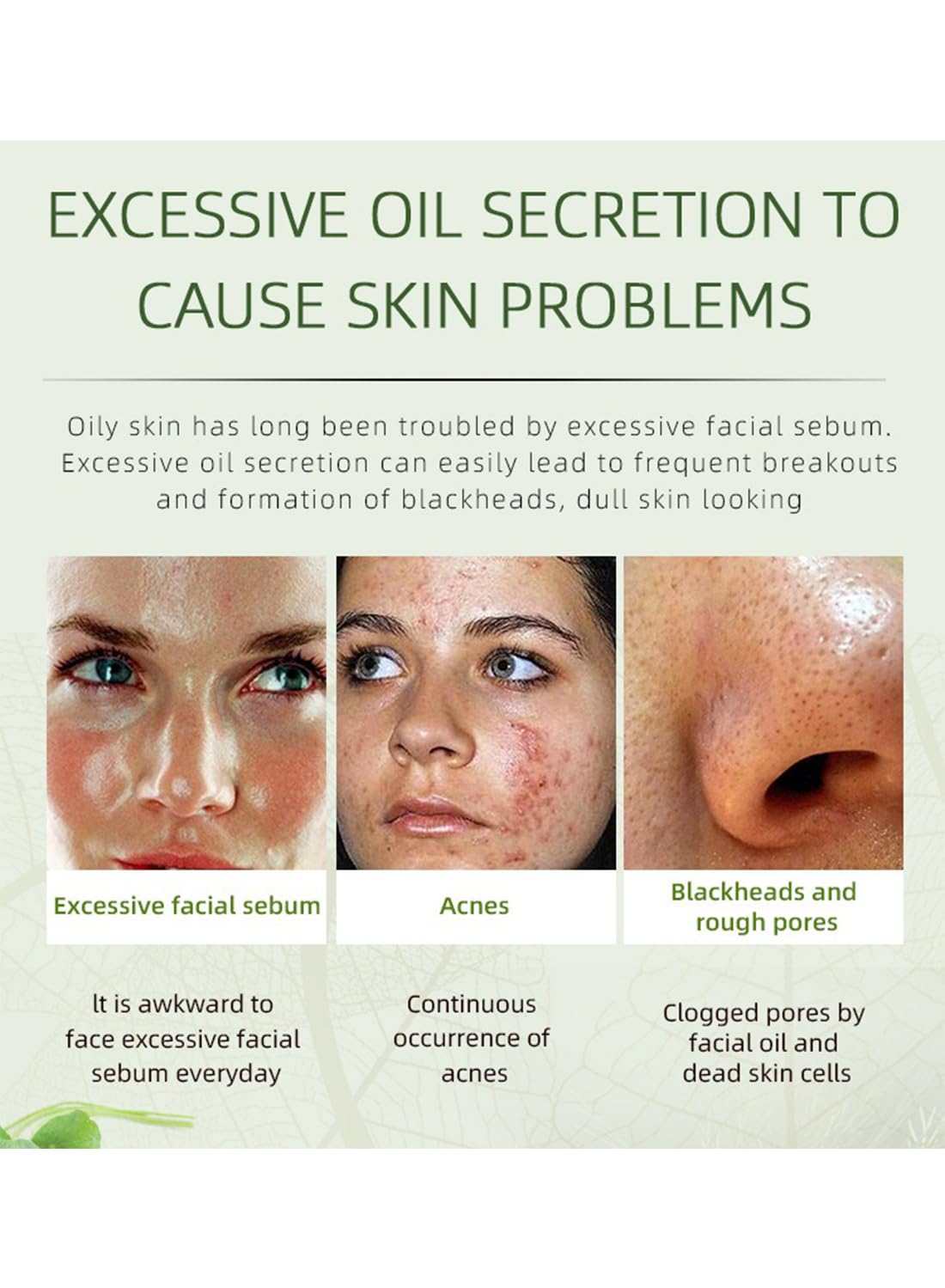 Acne Treatment Face Cream, Herbal Anti-Inflammation Soothing Acne Moisturizer with Tea Tree Oil, Acne Remover for Stubborn Pimple Blackhead Whitehead Blemish, Inflammation Relief 50g