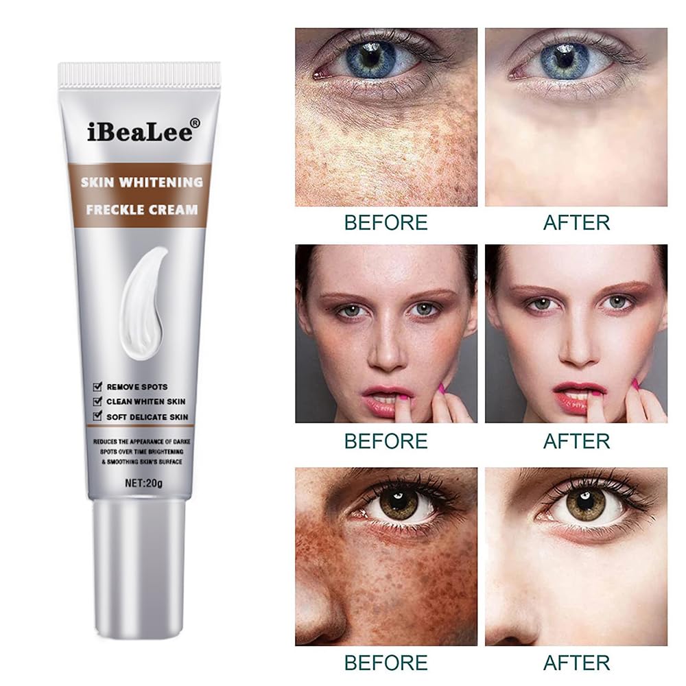 Whitening Facial Cream, Lightening and Freckle-Removing Cream - 20g