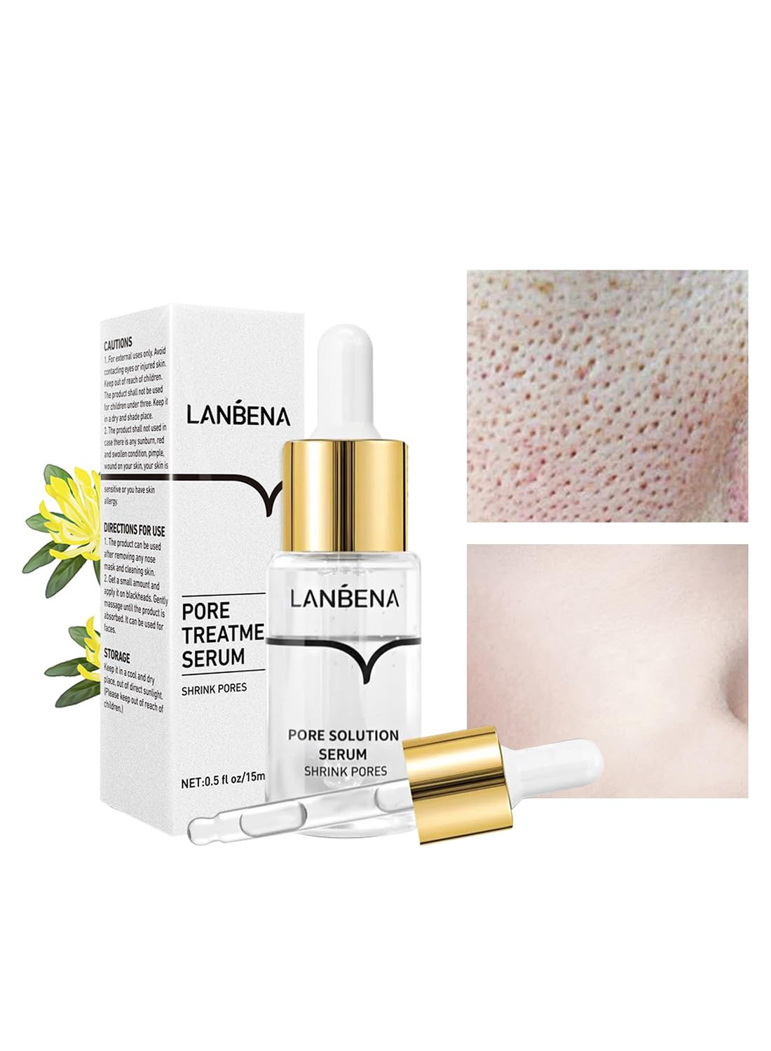 Blackhead Remover, Pore Solution Serum for Face and Nose 15ml