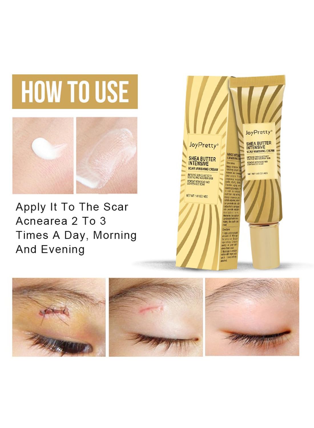Scar Reducing Treatment, Intensive Repairing Scar Cream from Burns, Surgery 40g