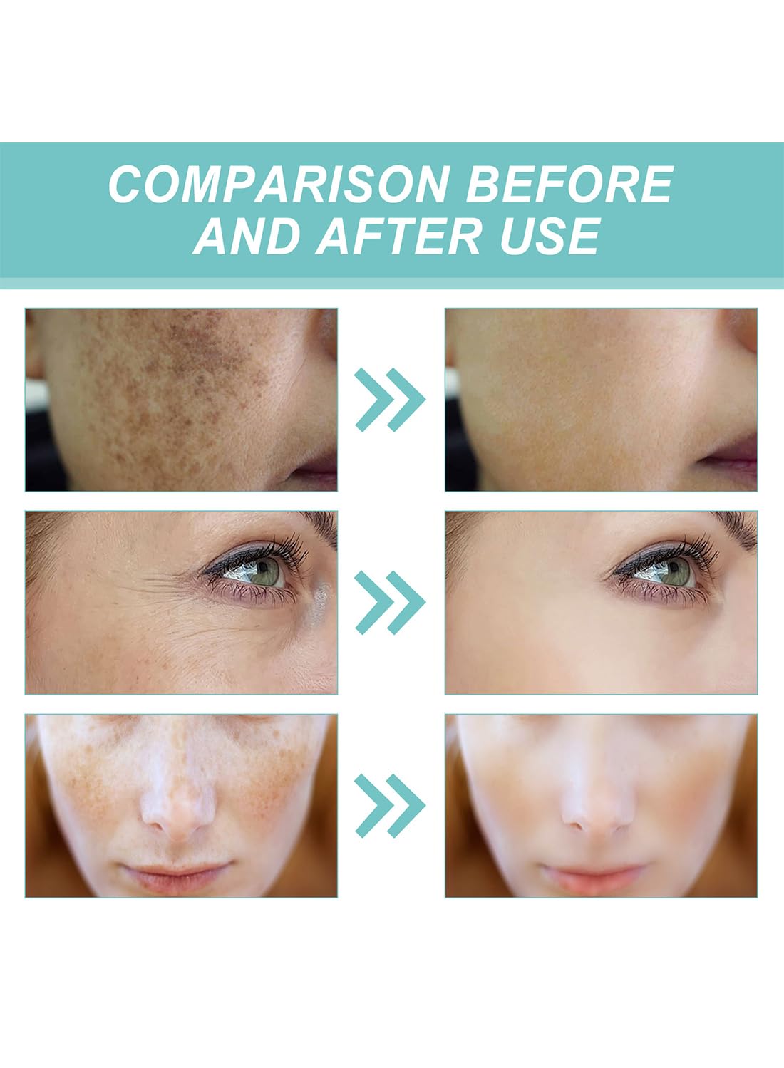 Dark Spot Corrector, Moisturizing Whitening Brightening Dark Spot Remover